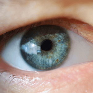 famosos blefaroplastia antes y despues