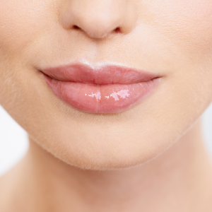 ¿Botox en los labios?