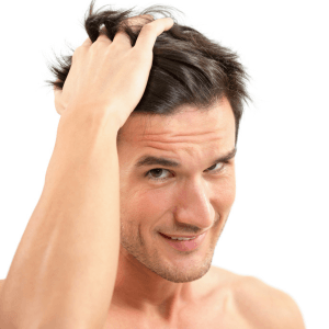 Consulta de valoración de injerto capilar gratuita en Murcia