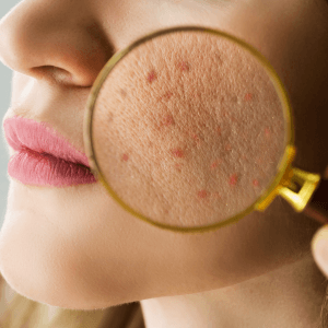 Dermatología en Cartagena