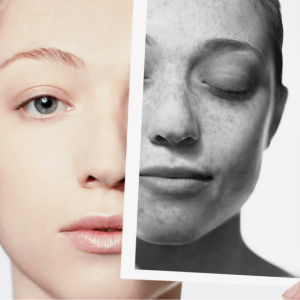 Encontrar al Mejor Dermatólogo en Cartagena