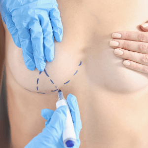 aumento de pecho cartagena