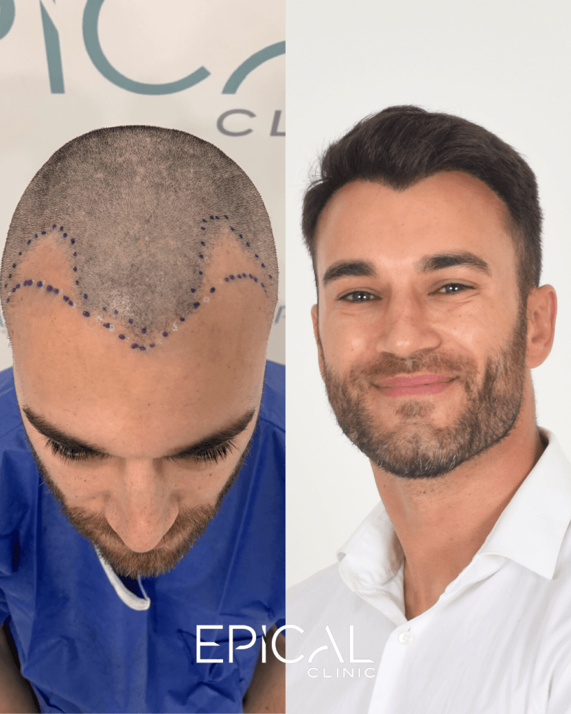 nuevos formato casos resultados logo greci (1080 x 1350 px) (4)