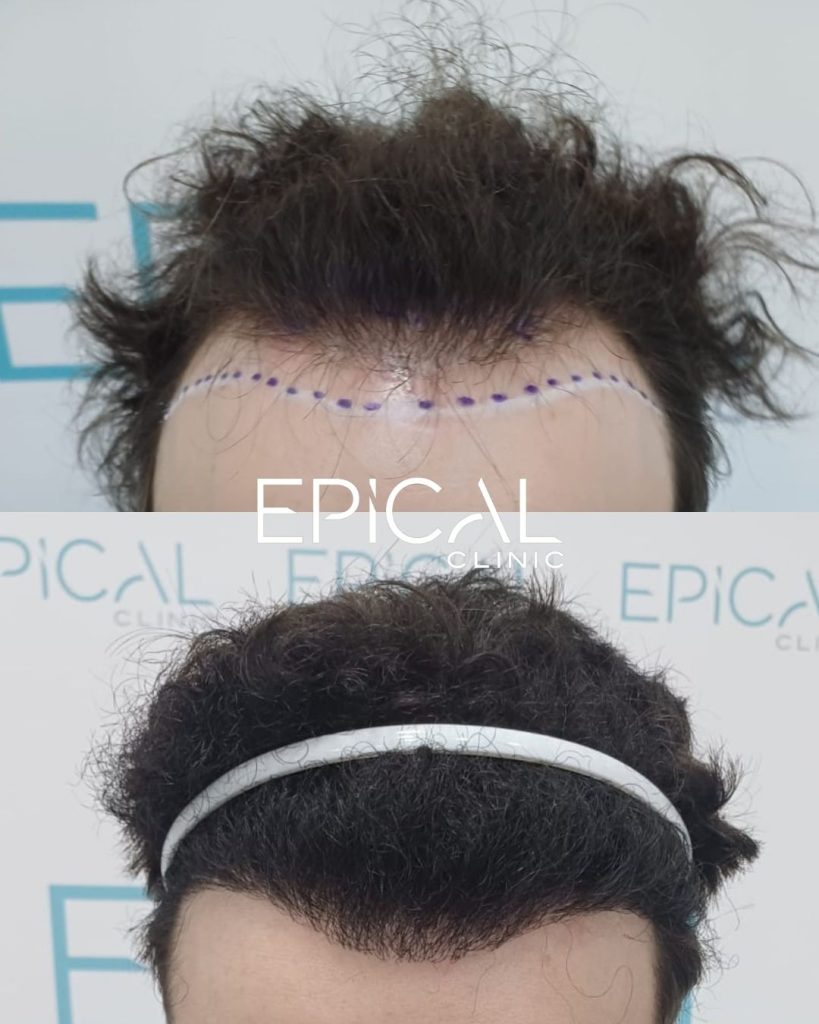 nuevos formato casos resultados logo greci (1080 x 1350 px)